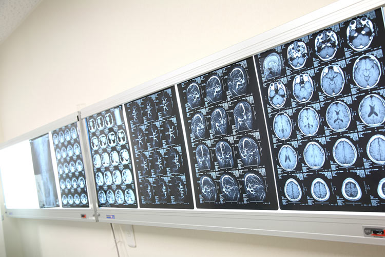 脳神経内科イメージ